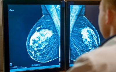 RESEARCHERS DEVELOPED A 4D PRINT PERSONALIZED “SMART IMPLANTS” TO TREAT BREAST CANCER