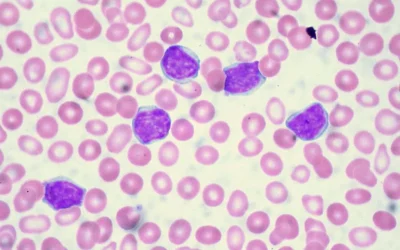 Revolutionizing leukemia diagnosis with Alercell’s  TED test
