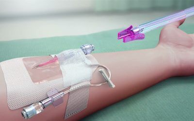 Needle-Free Blood Draw Technology Redefines Hospital Procedures