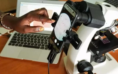 An innovative AI-based Malaria diagnosis system