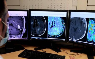 Catalan researchers validated an AI tool that identifies 3 Brain tumor types with 78% accuracy