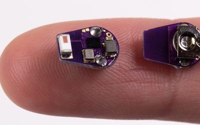 Implantable wireless sensor monitores inflamation leading timelier crohn’s disease treatment