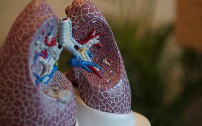 A test to detect the risk of lung cancer using artificial intelligence