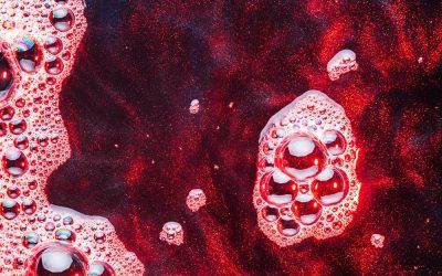 New AI solution predicts painful crises in sickle cell disease early