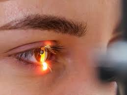 IA que detecta el riesgo de infarto a través de la retina