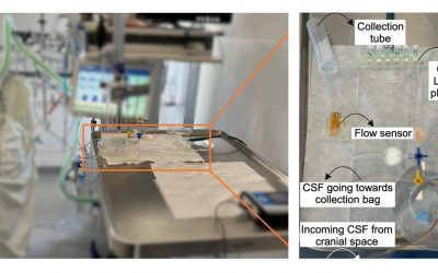 Monitor portátil analiza líquido cefalorraquídeo en tiempo real para detectar infección precoz