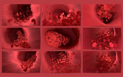 Investigadores crean una plataforma de «arteria en un chip» para predecir el riesgo de ictus