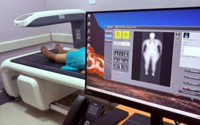 Reutilizar pruebas radiológicas para detectar sarcopenia con IA